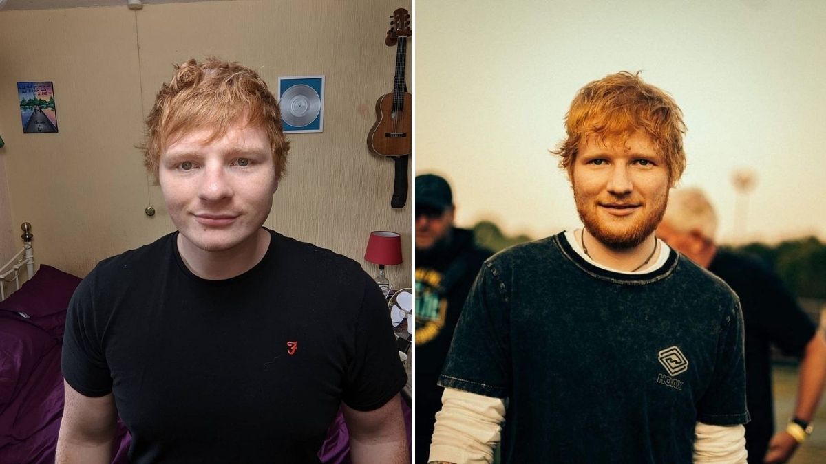 Gemelo Ed Sheeran